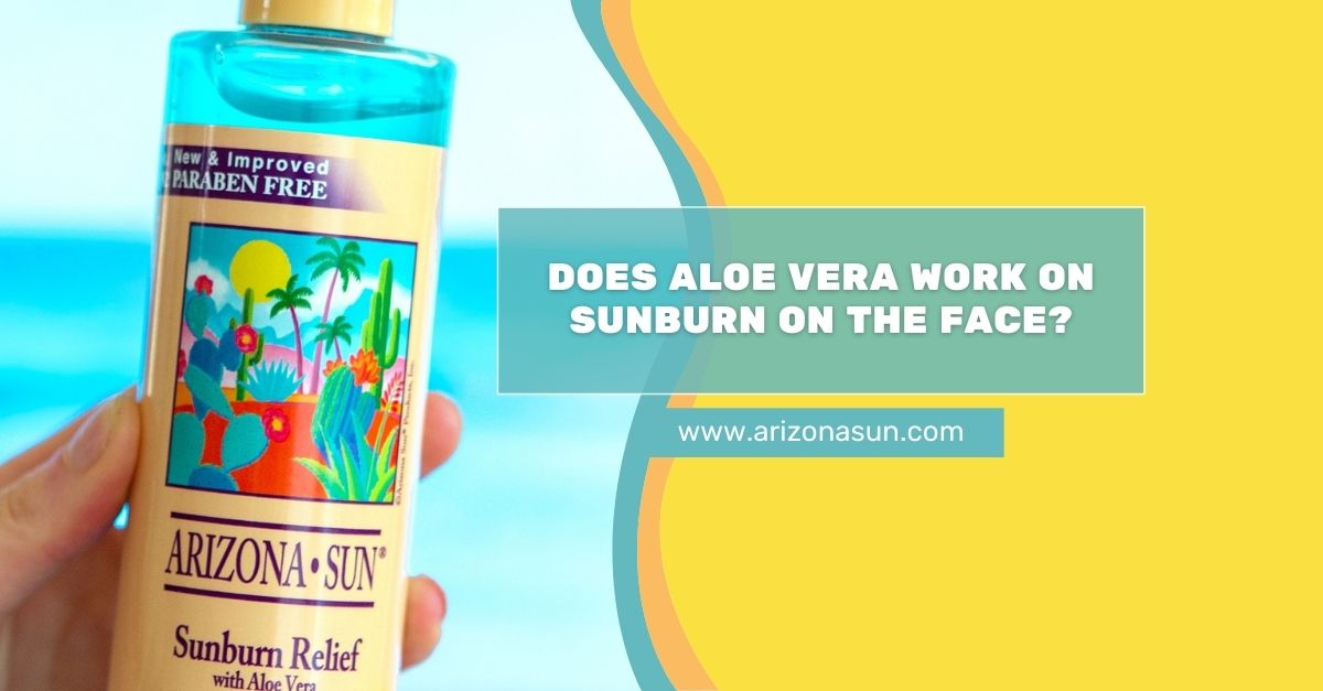 Aloe for Sunburn