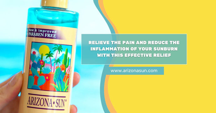 Aloe for Sunburn for Relieving the Pain and Reducing Inflammation