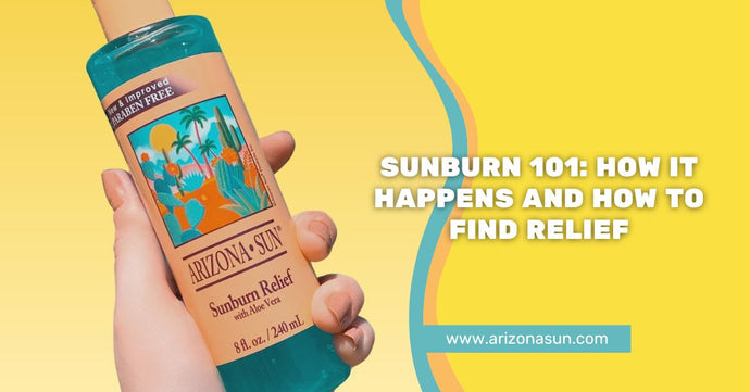 Sunburn 101: How It Happens and How to Find Relief