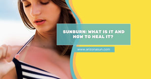 aloe for sunburn
