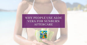 aloe vera for sunburn